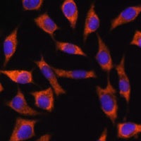 CHCHD2 Rabbit Polyclonal Antibody