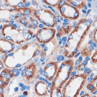 CHDH Rabbit Polyclonal Antibody