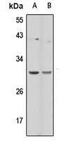 PCLN-1 Rabbit Polyclonal Antibody