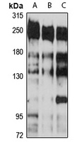 CNOT1 Rabbit Polyclonal Antibody