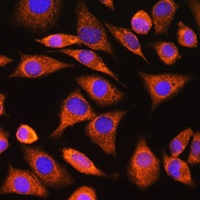 CNOT1 Rabbit Polyclonal Antibody