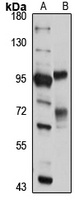 CNOT10 Rabbit Polyclonal Antibody
