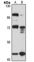 COLGALT2 Rabbit Polyclonal Antibody