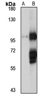 COPG2 Rabbit Polyclonal Antibody