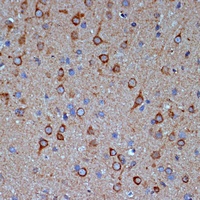 COPG2 Rabbit Polyclonal Antibody