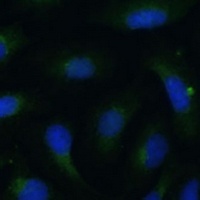 COPG2 Rabbit Polyclonal Antibody