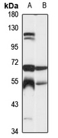 CPVL Rabbit Polyclonal Antibody