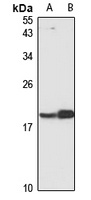 CRCP Rabbit Polyclonal Antibody