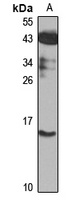 Cystatin S Rabbit Polyclonal Antibody
