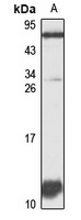 CXCL14 Rabbit Polyclonal Antibody