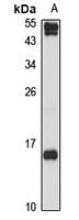 CXCL9 Rabbit Polyclonal Antibody