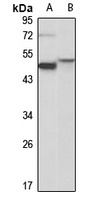 Cytochrome P450 19A1 Rabbit Polyclonal Antibody