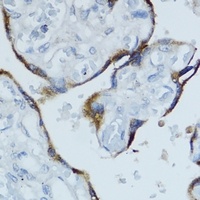 Cytochrome P450 19A1 Rabbit Polyclonal Antibody