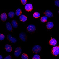 Cytochrome P450 19A1 Rabbit Polyclonal Antibody