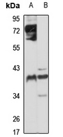 CYR61 Rabbit Polyclonal Antibody
