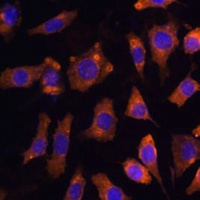 CYR61 Rabbit Polyclonal Antibody