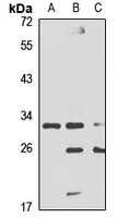 DAZL Rabbit Polyclonal Antibody