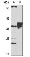 DAZL Rabbit Polyclonal Antibody