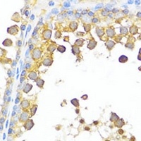 DAZL Rabbit Polyclonal Antibody