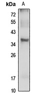 DBP Rabbit Polyclonal Antibody