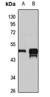 WDSOF1 Rabbit Polyclonal Antibody