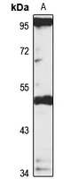 DC-STAMP Rabbit Polyclonal Antibody