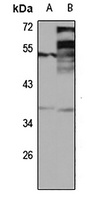 DEDD2 Rabbit Polyclonal Antibody