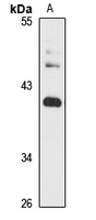 DEGS1 Rabbit Polyclonal Antibody