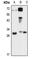DENR Rabbit Polyclonal Antibody