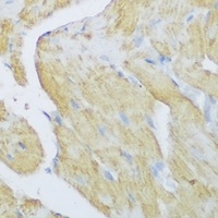 DENR Rabbit Polyclonal Antibody