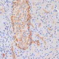 DLL1 Rabbit Polyclonal Antibody
