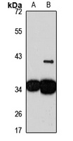 DNAJC9 Rabbit Polyclonal Antibody