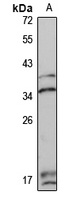 DNASE1L1 Rabbit Polyclonal Antibody