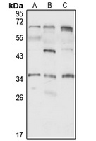 TdTIF1 Rabbit Polyclonal Antibody