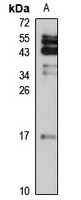 Destrin Rabbit Polyclonal Antibody