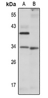 DUSP2 Rabbit Polyclonal Antibody