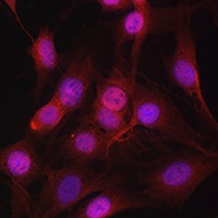 DYNLL1 Rabbit Polyclonal Antibody