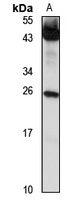 EDARADD Rabbit Polyclonal Antibody