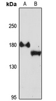 EDC4 Rabbit Polyclonal Antibody