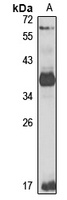 eIF3 beta Rabbit Polyclonal Antibody