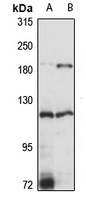 EPAS1 Rabbit Polyclonal Antibody