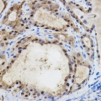 EPAS1 Rabbit Polyclonal Antibody