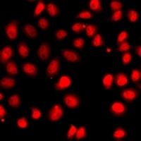 EPAS1 Rabbit Polyclonal Antibody