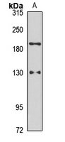 PARS Rabbit Polyclonal Antibody