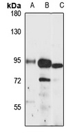 TFIIH p89 Rabbit Polyclonal Antibody