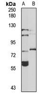TFIIH p89 Rabbit Polyclonal Antibody
