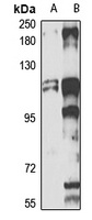 PICH Rabbit Polyclonal Antibody