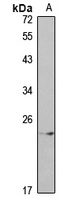 FGF10 Rabbit Polyclonal Antibody
