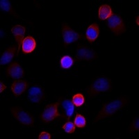 Filamin-2 Rabbit Polyclonal Antibody