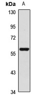 FLVCR1 Rabbit Polyclonal Antibody